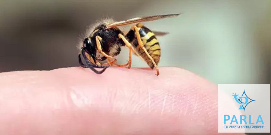 Arı Sokmaları